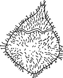 Pseudoceratium anaphrissum.jpg